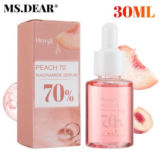Niacinamide Melasma Corrector Serum (30ml)